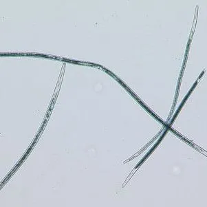 thumbnail for publication: Belonolaimus longicaudatus Rau (Nematoda: Secernentea: Tylenchida: Tylenchina: Belonolaimidae: Belonolaiminae)